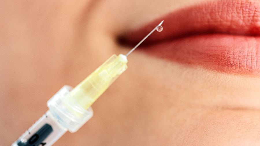hyaluronic-acid-lip-fillers